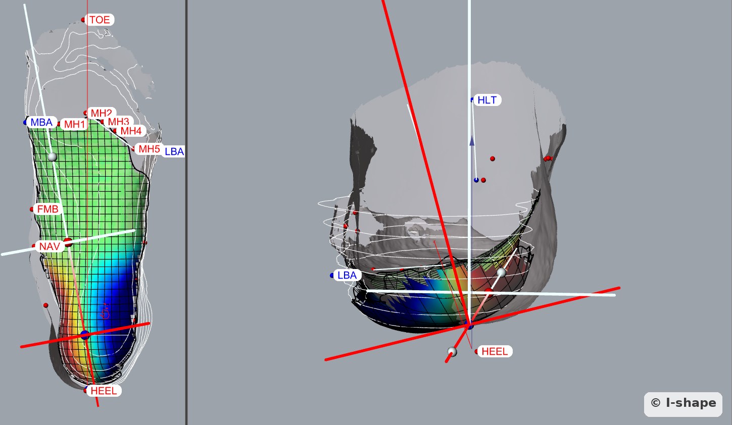 Corrections d’une semelle sur-mesure sur le logiciel 3D, avec les repères et axes du pied